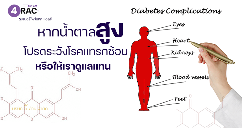 # super 4rac #oklifeshop #oklife 
#น้ำมังคุด #ซุปเปอร์โฟร์แรค #แซนโทน
 #เปลือกมังคุด
#super4rac #siamnutra #TAKO_Food #น้ำมังคุดทั้งเปลือก
#มังคุดทั้งผล #น้ำมังคุดสกัด #ต้านอนุมูลอิสระ #ลดการอักเสบ น้ำมังคุด SUPER 4RAC 
เพจหลัก #xanthone #Oracscore #คะแนนโอแรค #organic #ภูมิแพ้ #เบาหวาน #ไขมัน 
#ความดัน #มะเร็ง #ตับอักเสบ #เนื้องอก #หลอดเลือด #ประโยชน์น้ำมังคุด #น้ำมังคุด100% 
